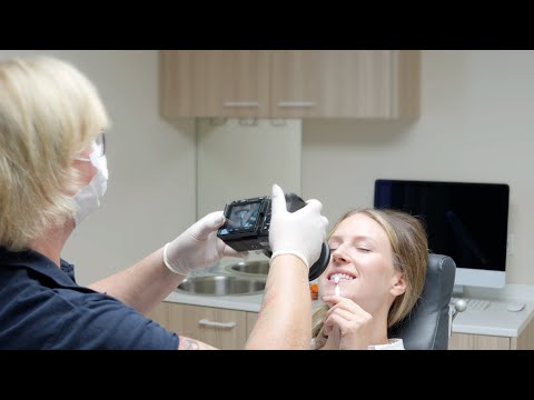 #howto fläsh In-Office Bleaching 08 von 08: Nach der Bleaching Behandlung