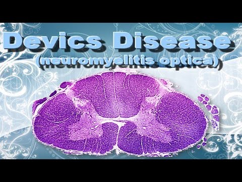 Devic's Disease