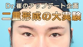 【Dr.崔のアップデート企画】次の手術は「二重まぶたの大実験！？」
