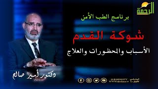شوكة القدم الأسباب والمحظورات والعلاج دكتور أمير صالح