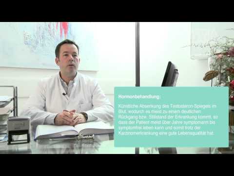 Prostatakrebs - Vertrauen in die Therapie