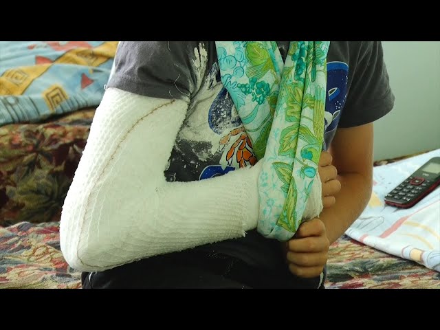 Сезонный травматизм