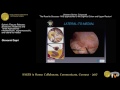 Splenic flexure release: Anatomic relations & 3 approaches-Inframesocolic, supramusocolic, and late