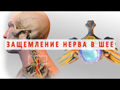 Гель для закачивания в коленный сустав Остеохондроз нижней части поясницы