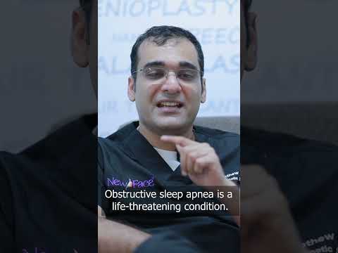 Do you have Obstructive Sleep Apnea? Dr Mathew PC talks about Snoring #shorts s