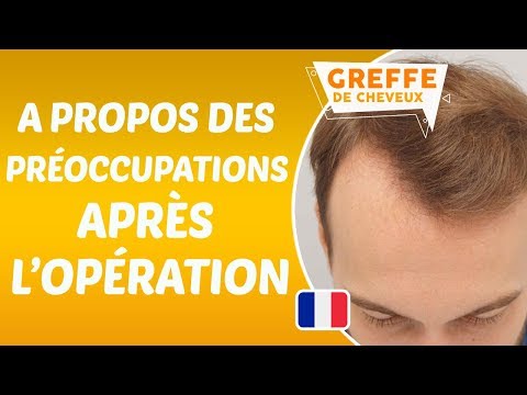 A propos des préoccupations des patients concernant l'opération de greffe de cheveux.