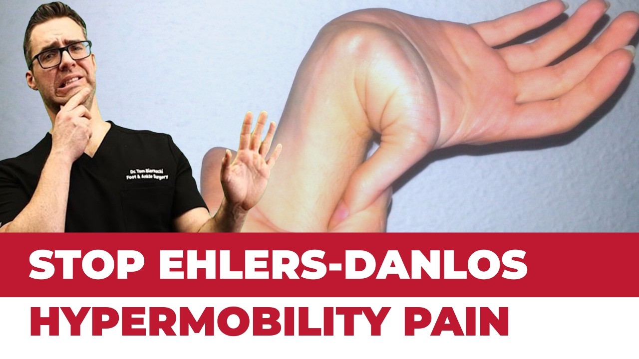 Top 10 Treatments for Ehlers Danlos Disease & Hypermobility Syndrome
