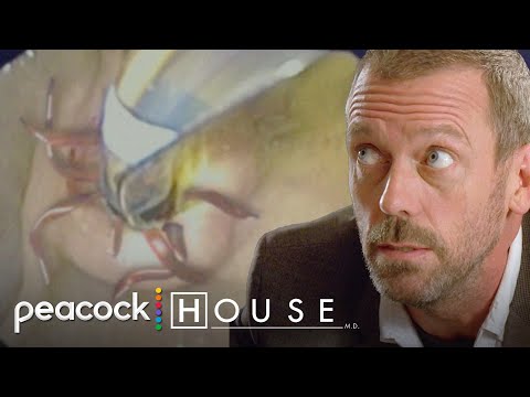 "His Liver is Completely Filled With Worms" | House M.D.