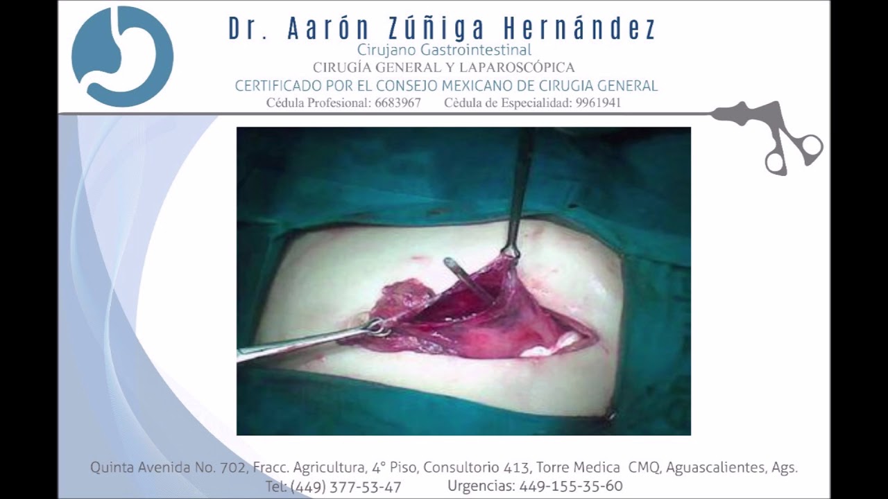 Aarón Zúñiga Hernández-14