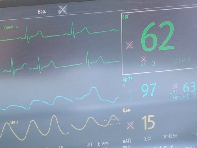 Врачам не хватает времени на спасение
