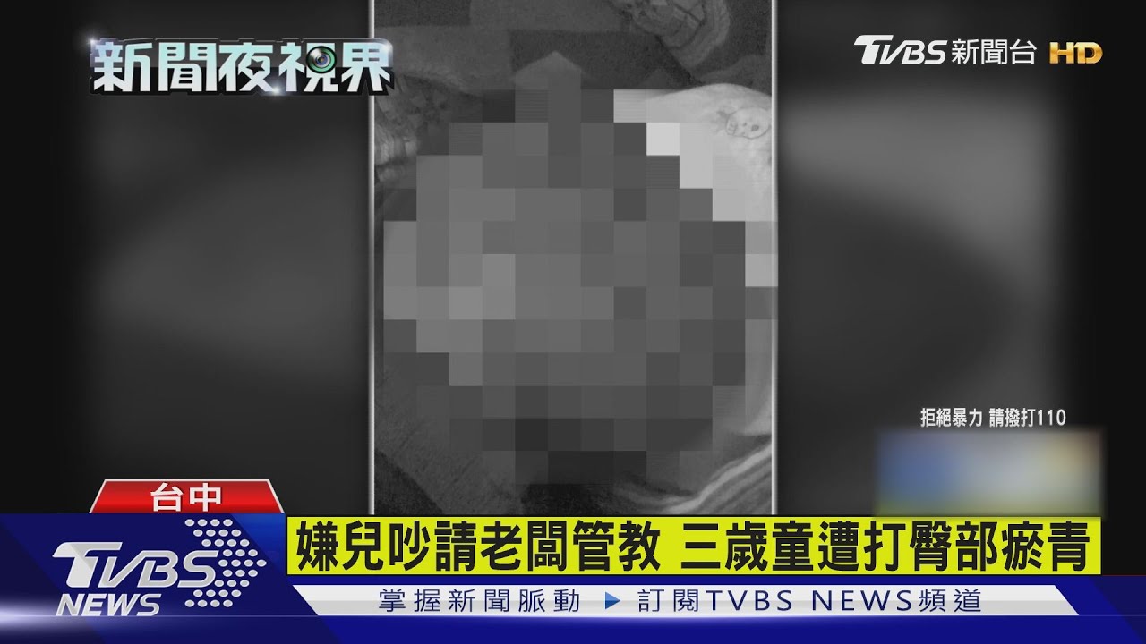 嫌兒吵請老闆管教 三歲童遭打臀部瘀青
