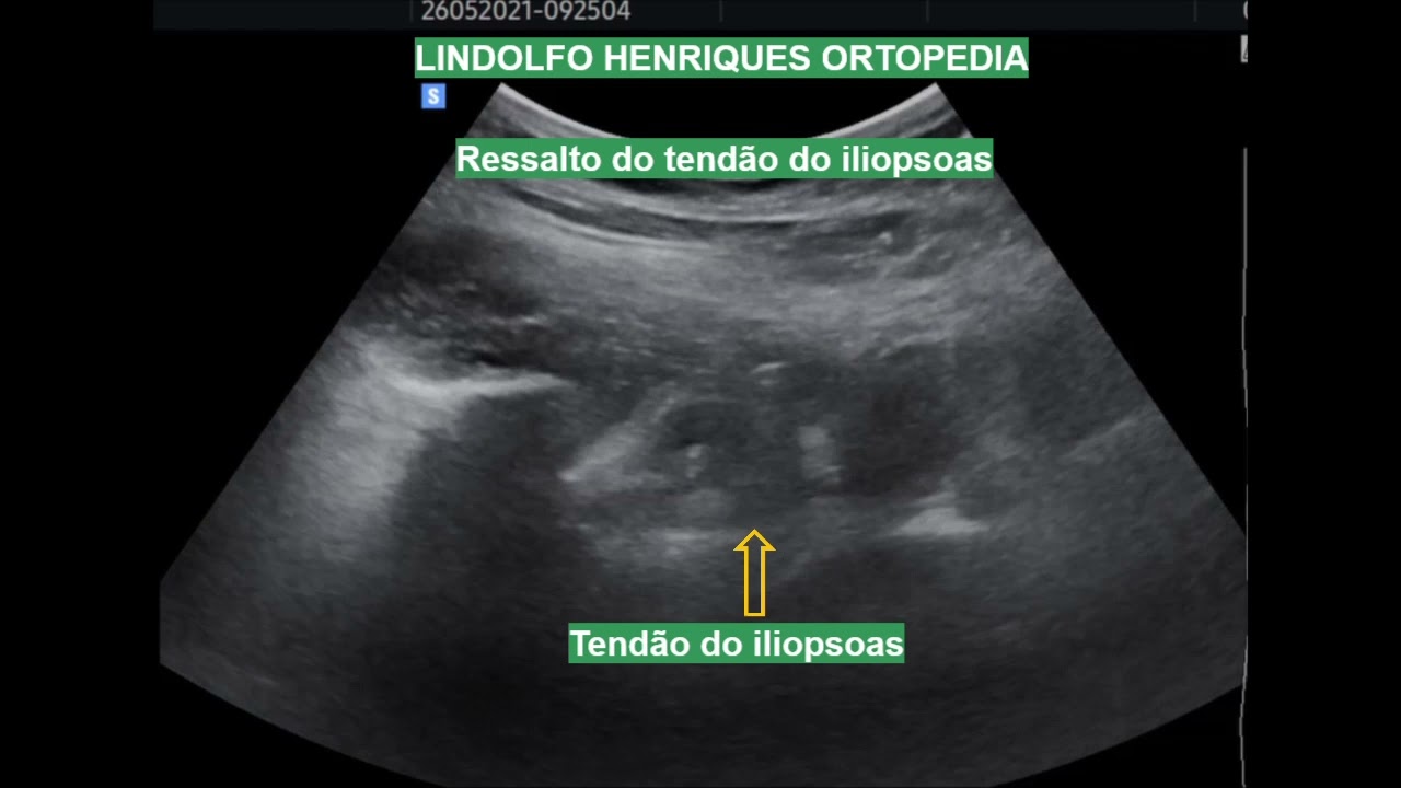 Lindolfo Henriques-12