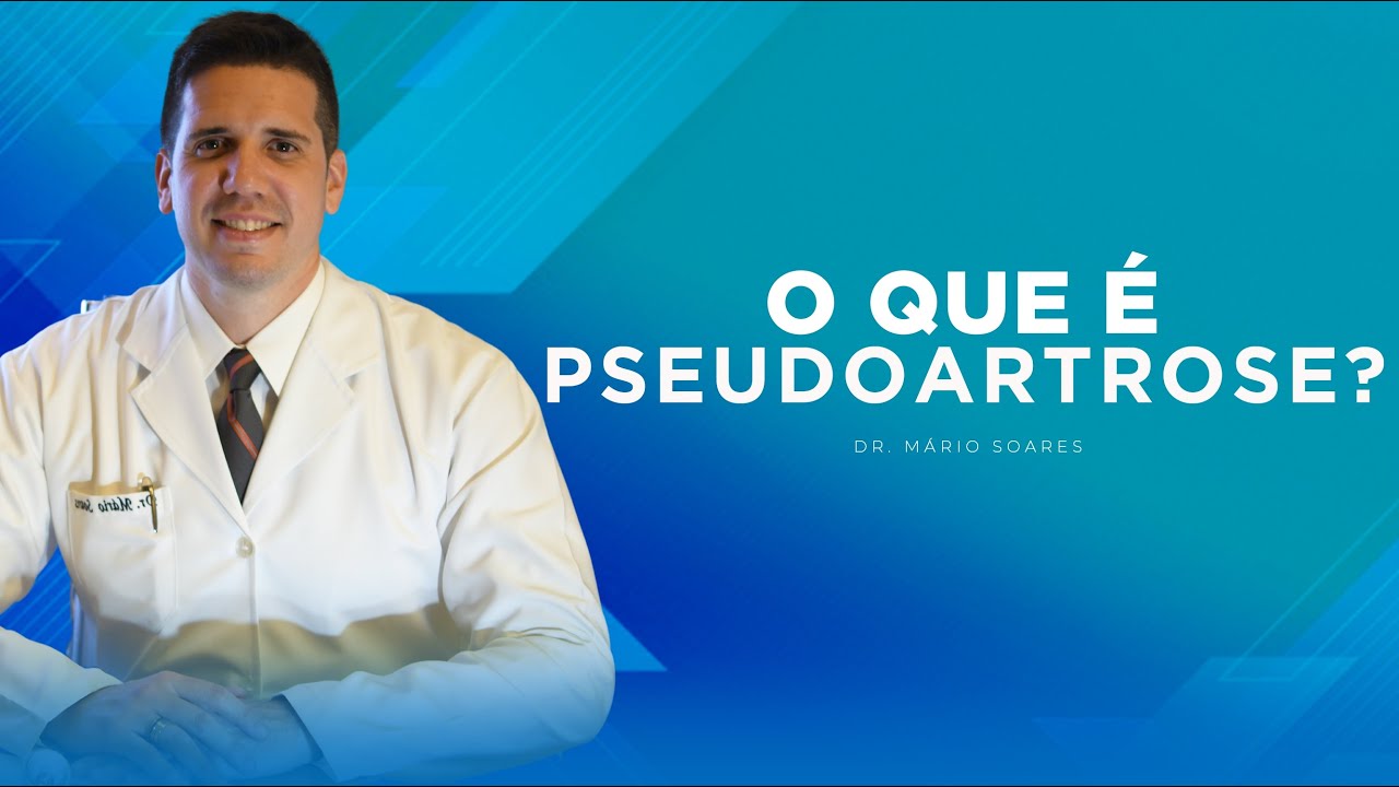 O que é Pseudoartrose? | Dr. Mário Soares