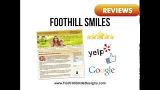 preview picture of video 'Foothill Smiles Dentists REVIEWS Foothill Ranch CA Dentists Reviews'