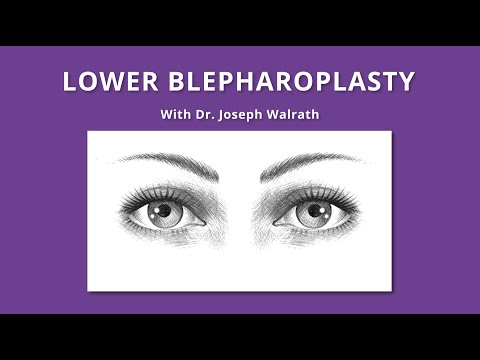 Lower Blepharoplasty