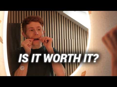 I Wish I'd Known This Before Getting Invisalign