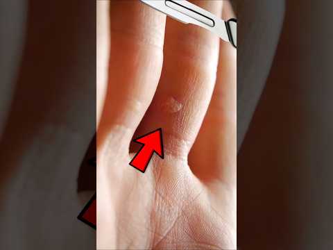 Perché NESSUNO te le vuole TAGLIARE? 😳 - Edonikko