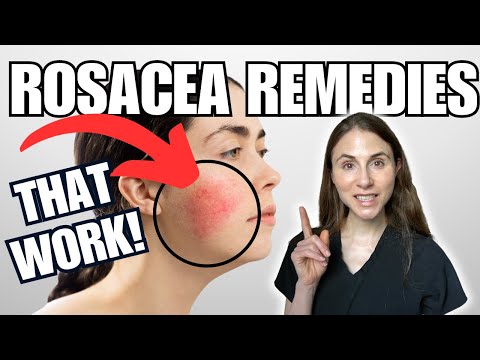 5 Rosacea Remedies THAT WORK | Dermatologist Tips