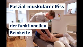 Chiropraktik | Faszial-muskulärer Riss der funktionellen Beinkette | mit Inan | deutsch | #79