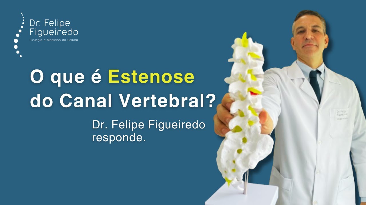 Felipe Figueiredo-20