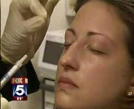 Non Surgical Nose Job By Dr. Cameron Rokhsar