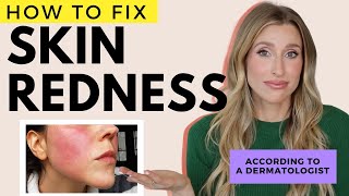 Fix Redness on the Face and Body | Dr. Sam Ellis