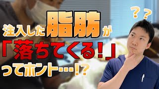 【脂肪注入】注入した脂肪が落ちてくるってホント？！【美容整形】