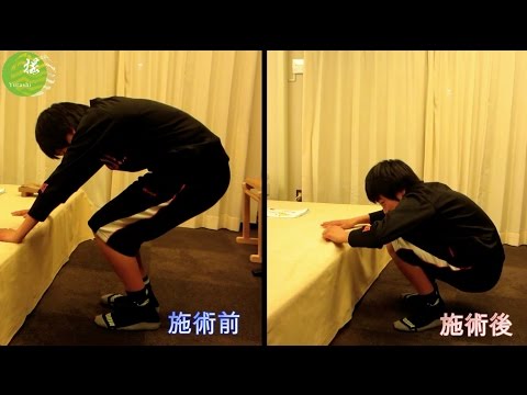 オスグッド・シュラッター病 の代表症例 動画サムネイル