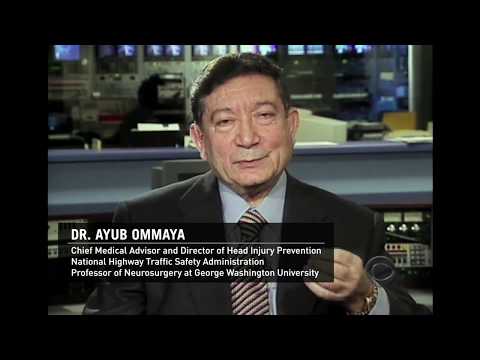 Ayub Ommaya about Shaken Baby Syndrome