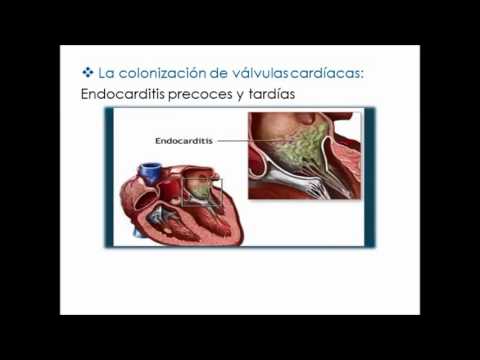 Prostata compresse terapia del cancro Esercizio della prostata per le immagini degli uomini