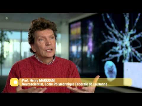 Unraveling The Human Brain