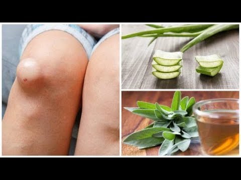 Bild Anatomie des Knies Behandelt trockene Gelenke
