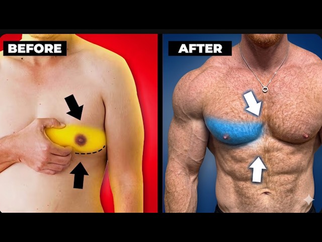 How to get rid of chest fat (its not how you think)