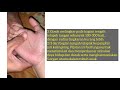 Pijat Tui Na Pada Anak Zyqrullah P201801008 L1 Keperawatan Kel 2 LAB