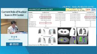 제4회 아산·세브란스 폐고혈압 공동 심포지엄 PH Academy 2024 : Current Role of Nuclear Scan in PH Center 미리보기