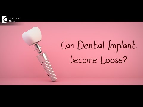 Can a Dental Implant become loose? Causes & Remedy