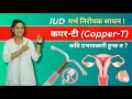 गर्भनिरोधक Copper T IUD Insertion Procedure How To Prevent Pregnancy Pregnancy K