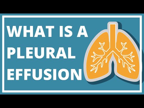 "它到底意味著什麼？"第五篇：胸腔積液 ("What Does It Really Mean?" Episode 5: Pleural Effusion)