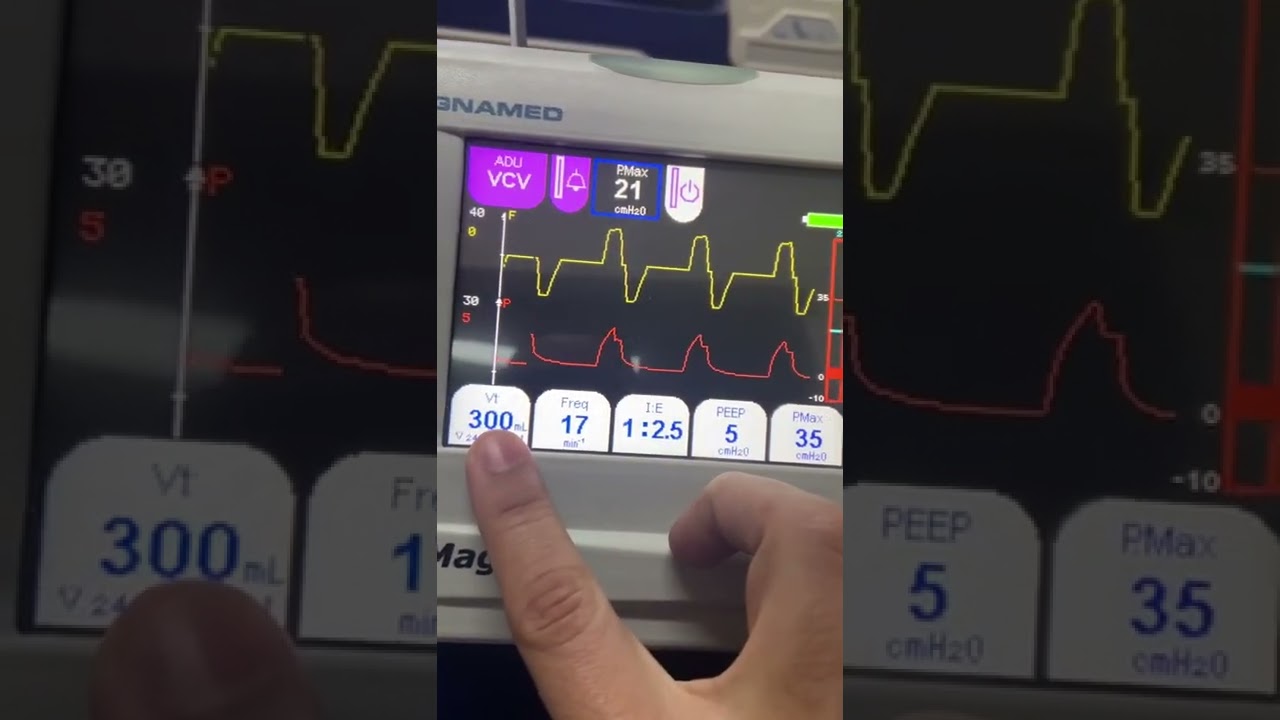 VM de transporte - OxyMag