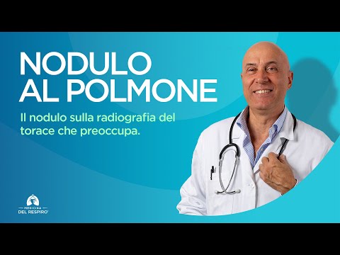NODULO AL POLMONE: Cos’è, Quando Preoccuparsi e Cosa Fare! 🫁