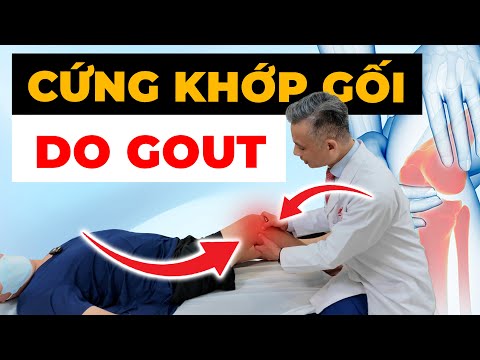 Khớp Gối Cứng Đờ Vì Gout - Đau Đến Mức Không Thể Đi Lại? Giải Pháp Tốt Nhất