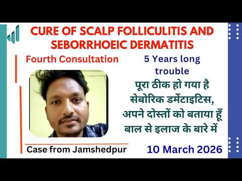 Cure of Scalp 5 years long Folliculitis and Seborrhoeic Dermatitis in a patient from Jamshedpur