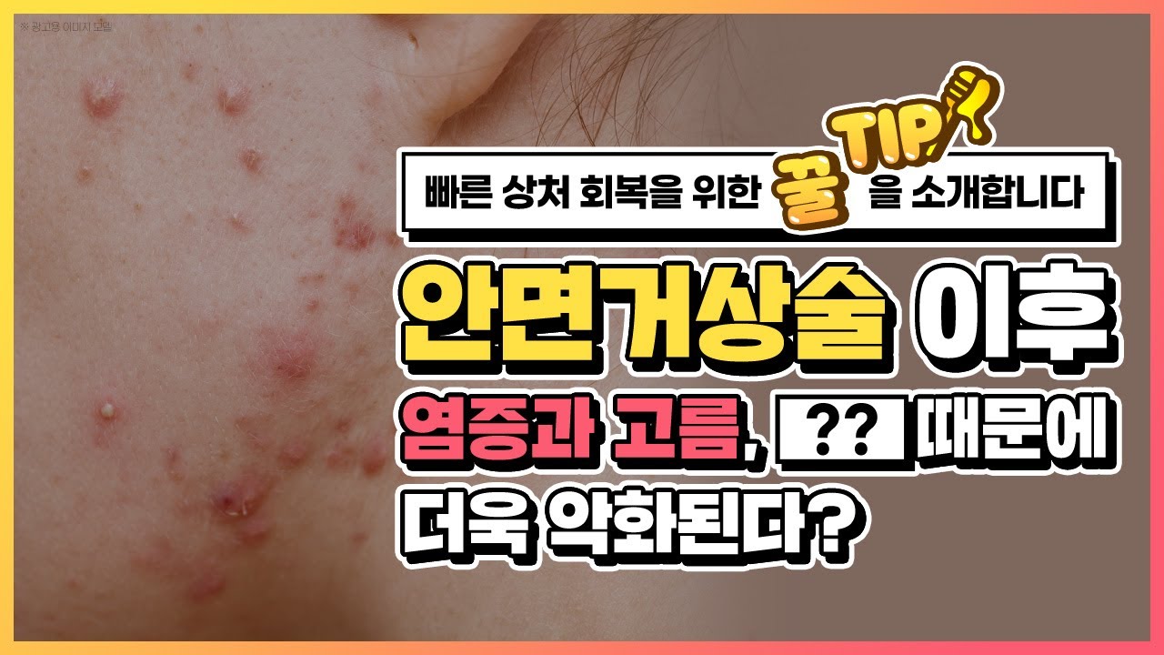 안면거상수술&안면거상재수술 이후 빠르게 회복하는 꿀tip | 안면거상술회복기간 | 키다리성형외과