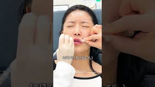 얼굴에 볼륨이 필요할 때? 쥬베룩볼륨!