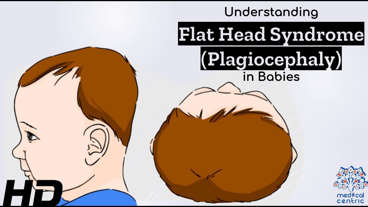 Can a flat head cause problems?