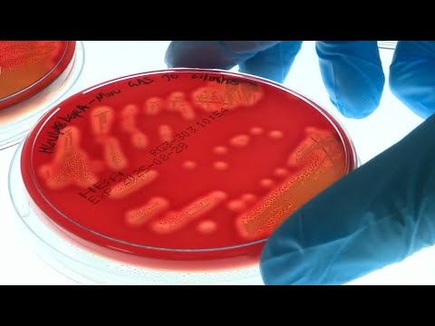 Nipah virus prompts heightened border security in Asia as two cases detected in India