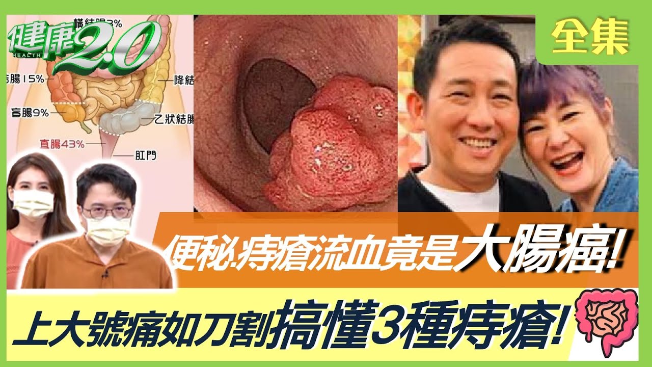 余苑綺病逝!婦超養生仍罹大腸癌 醫揭元凶:天天一杯恐出事