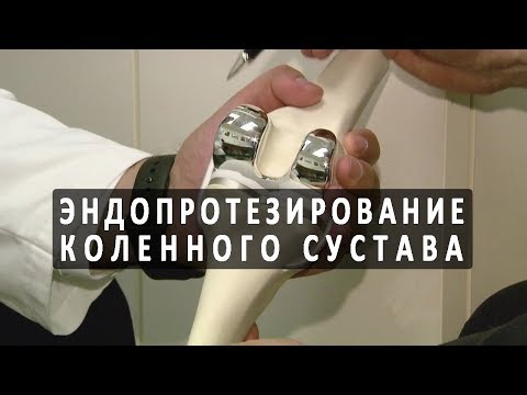 Мази при остеохондрозе шейного Внутрисуставная инъекция в коленный сустав отзывы
