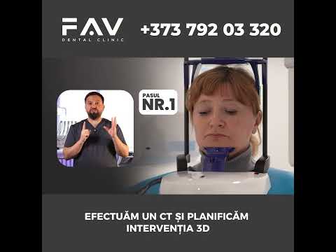 Dinți noi, fără durere!