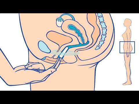 OB Tampons vs Tampax